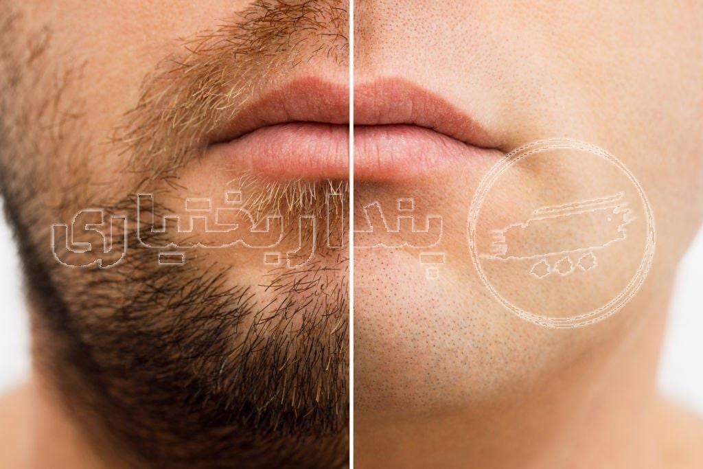 قبل و بعد آرایشگری مردانه